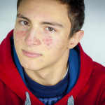 Portrait of teenage boy with acne